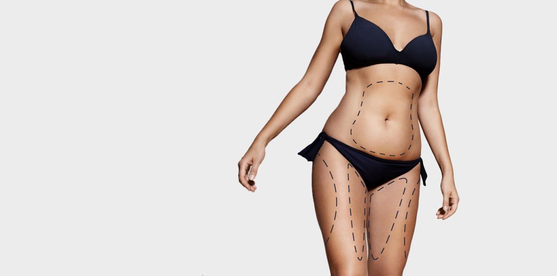 Liposuction1(1)-878ae66b-98d7-4132-94c6-7727b3cf0cfe